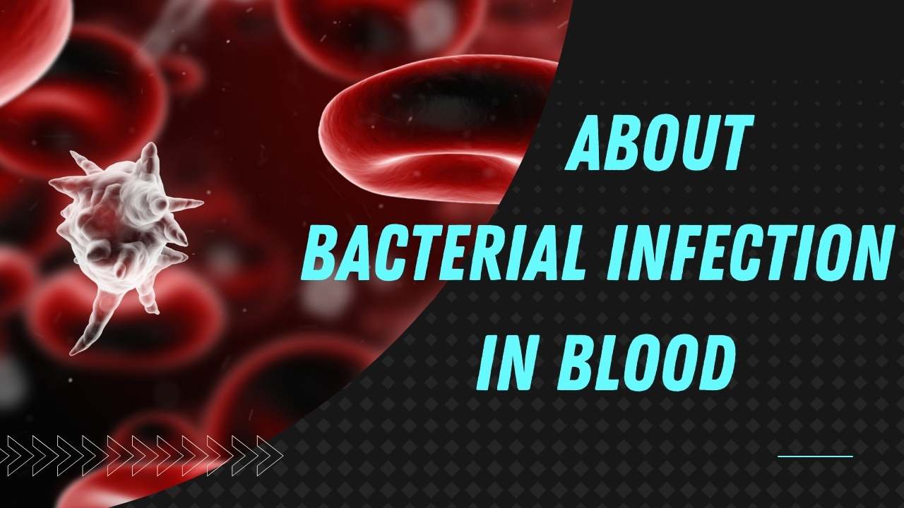 About Bacterial Infection In Blood.