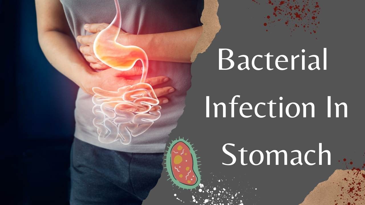 Bacterial Infection In Stomach short info
