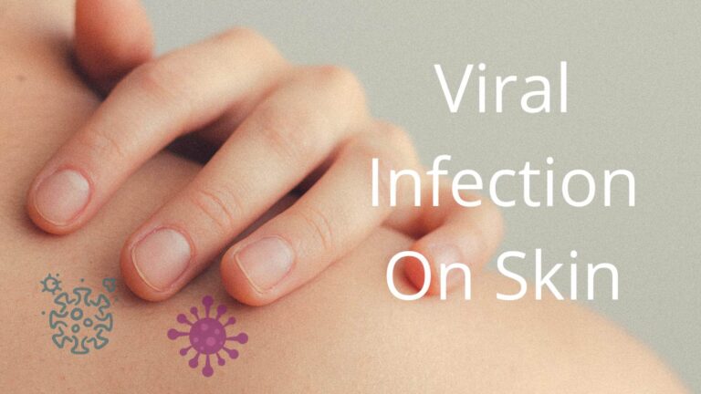 A Simple Guide To The Most Common Skin Infections Sillypharma