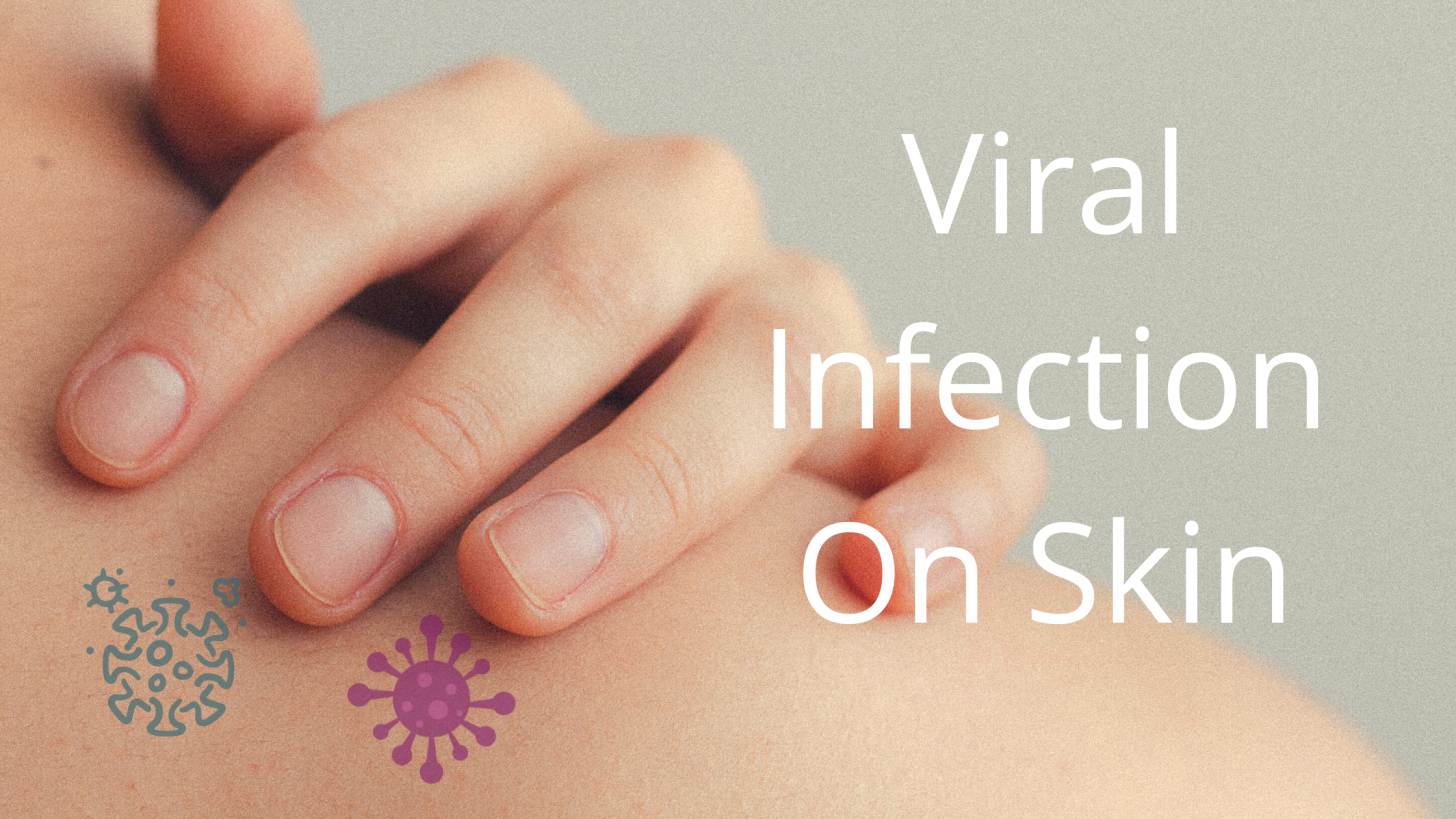 Viral Infection On Skin