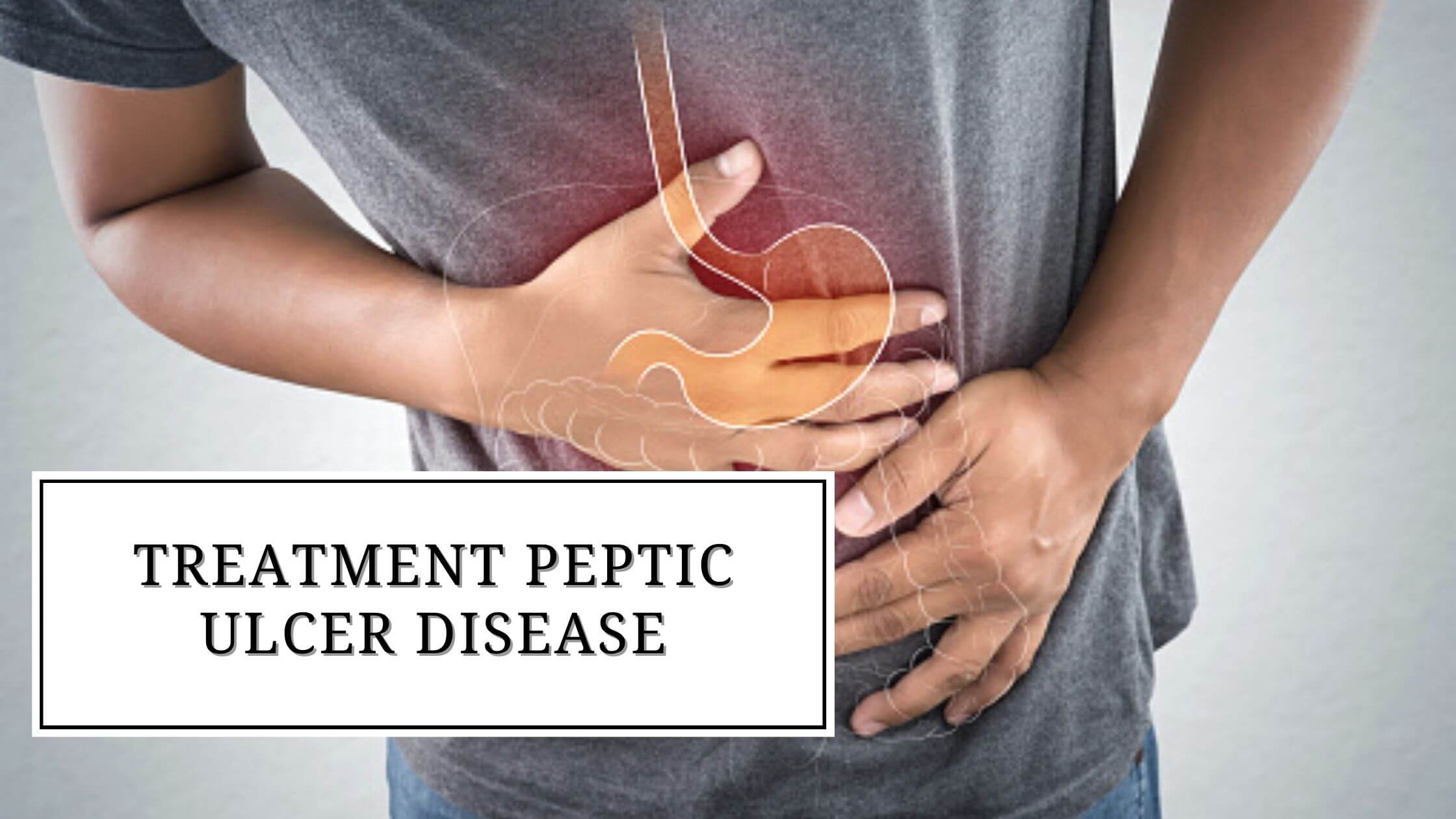 Treatment peptic ulcer disease